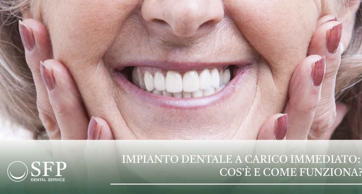 SFP Dental Service | impianto_dentale_carico_immediato