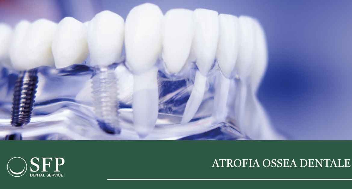 atrofia-ossea-dentale