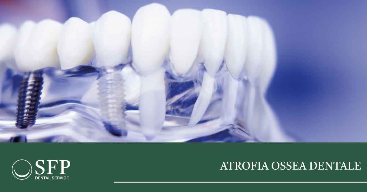 atrofia-ossea-dentale