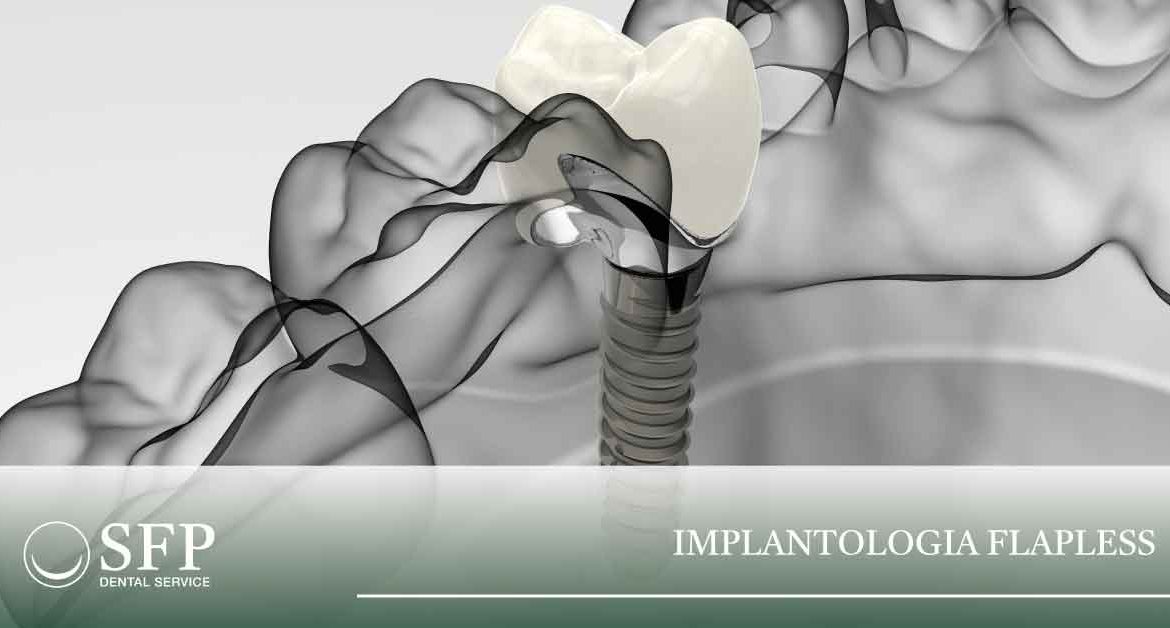 IMPLANTOLOGIA FLAPLESS