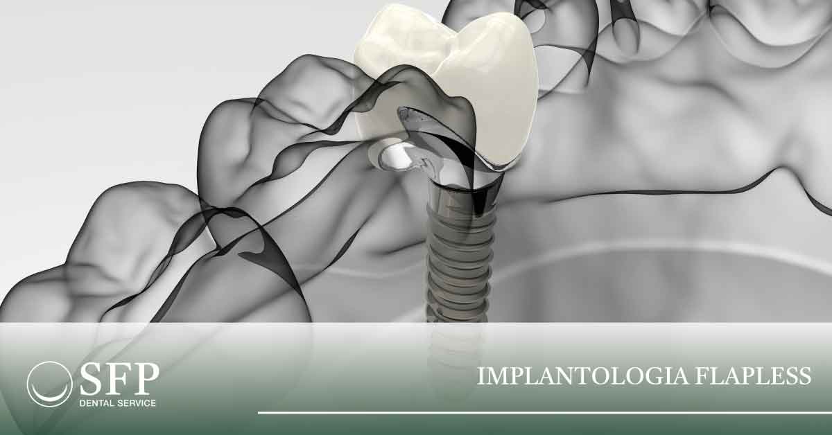 IMPLANTOLOGIA FLAPLESS