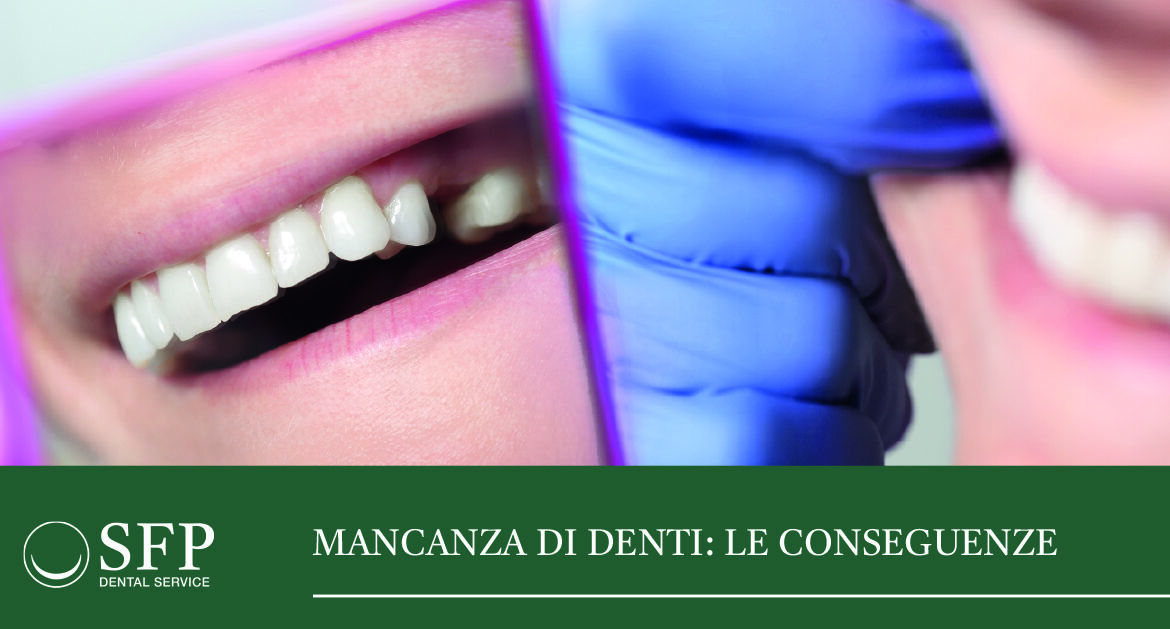 Conseguenze mancanza di denti