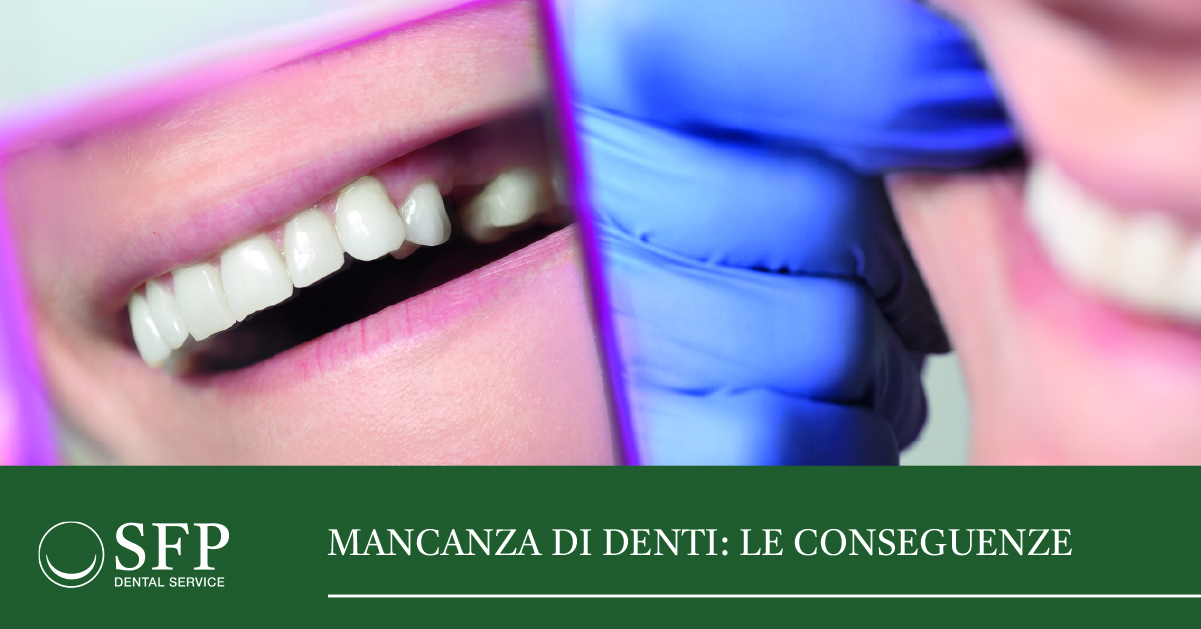 Conseguenze mancanza di denti